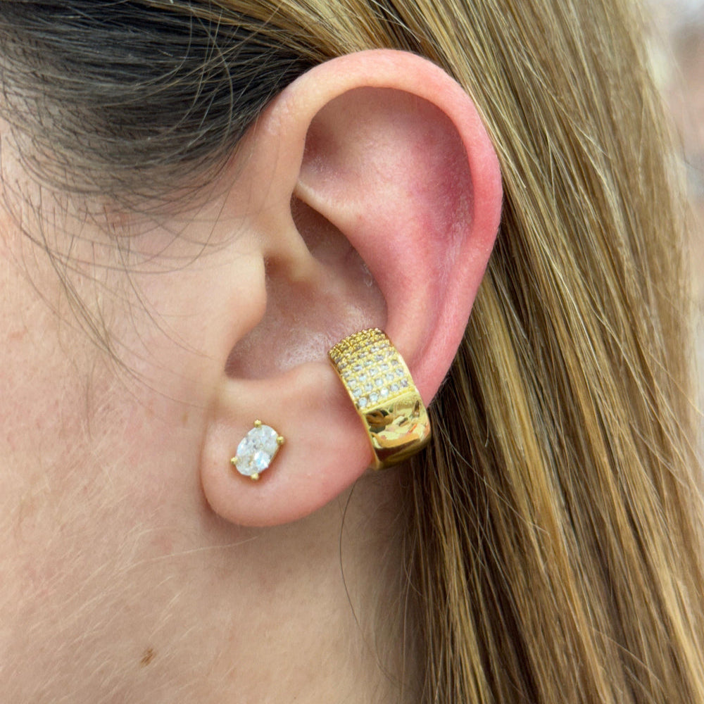 FULL ZIRCONIA CUFF